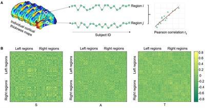 Common and Distinct Disruptions of Cortical Surface Morphology Between Autism Spectrum Disorder Children With and Without SHANK3 Deficiency